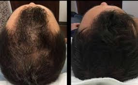 vor und nach dem Auftragen von vita hair man